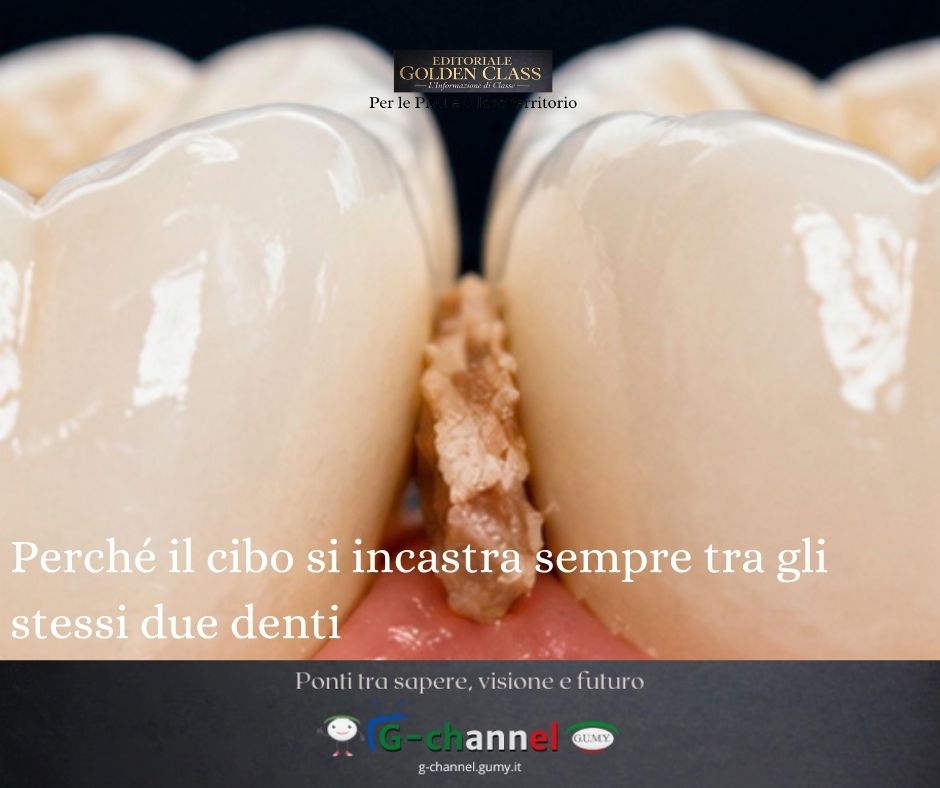 Perché il cibo si incastra sempre tra gli stessi due denti